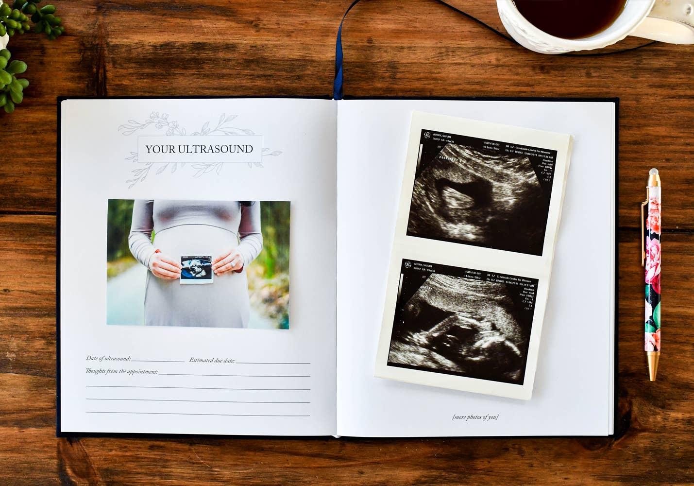 Dear Baby: A Pregnancy Journal