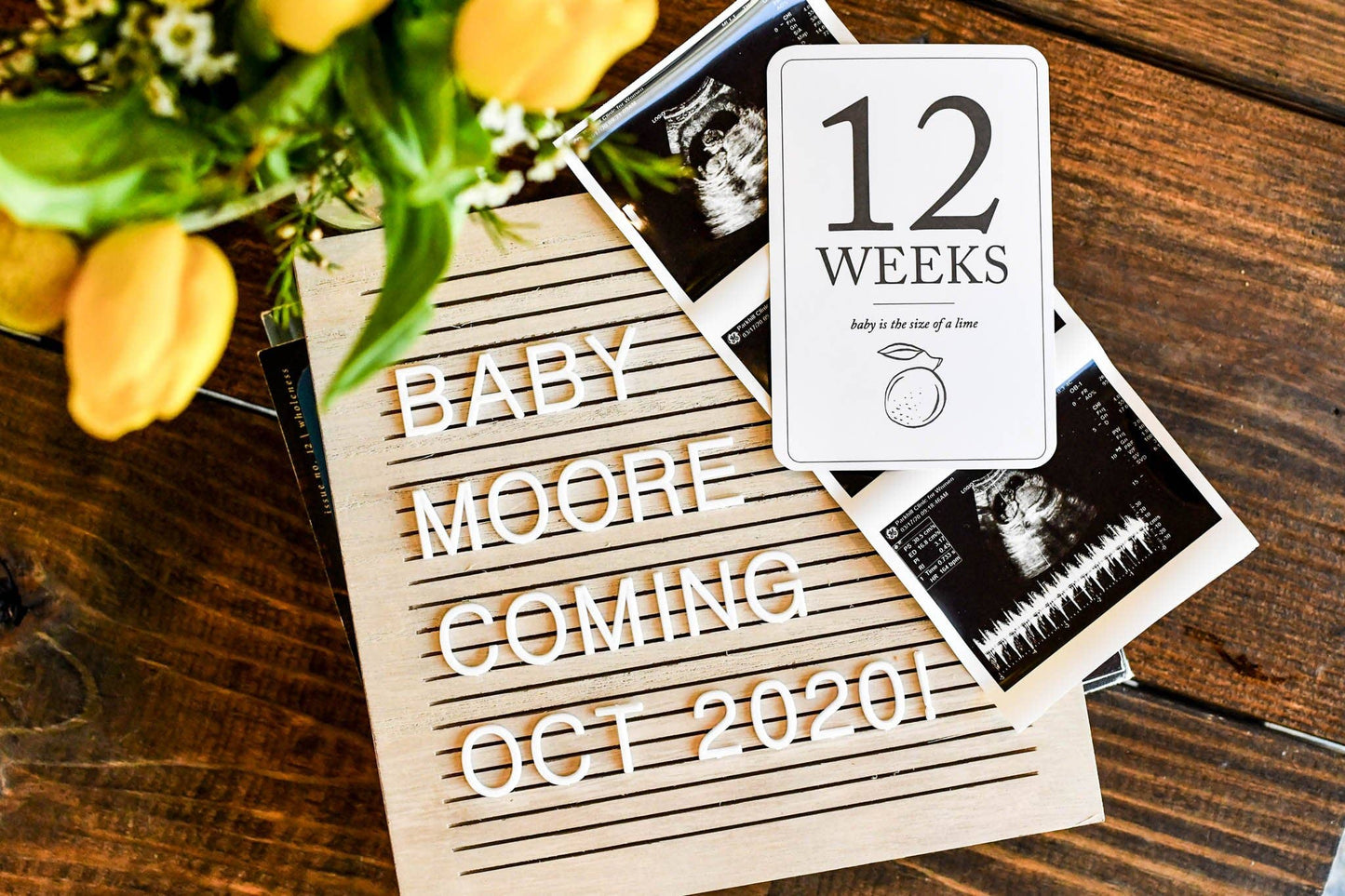 Pregnancy Milestone Cards